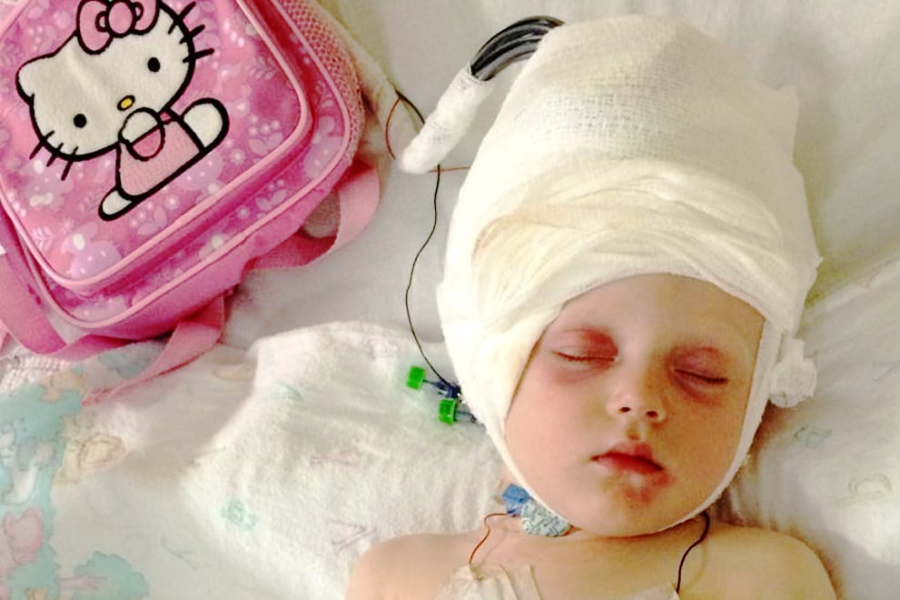 Molly’s neurological symptoms first appeared when she was one month old. Her condition would eventually require surgery.