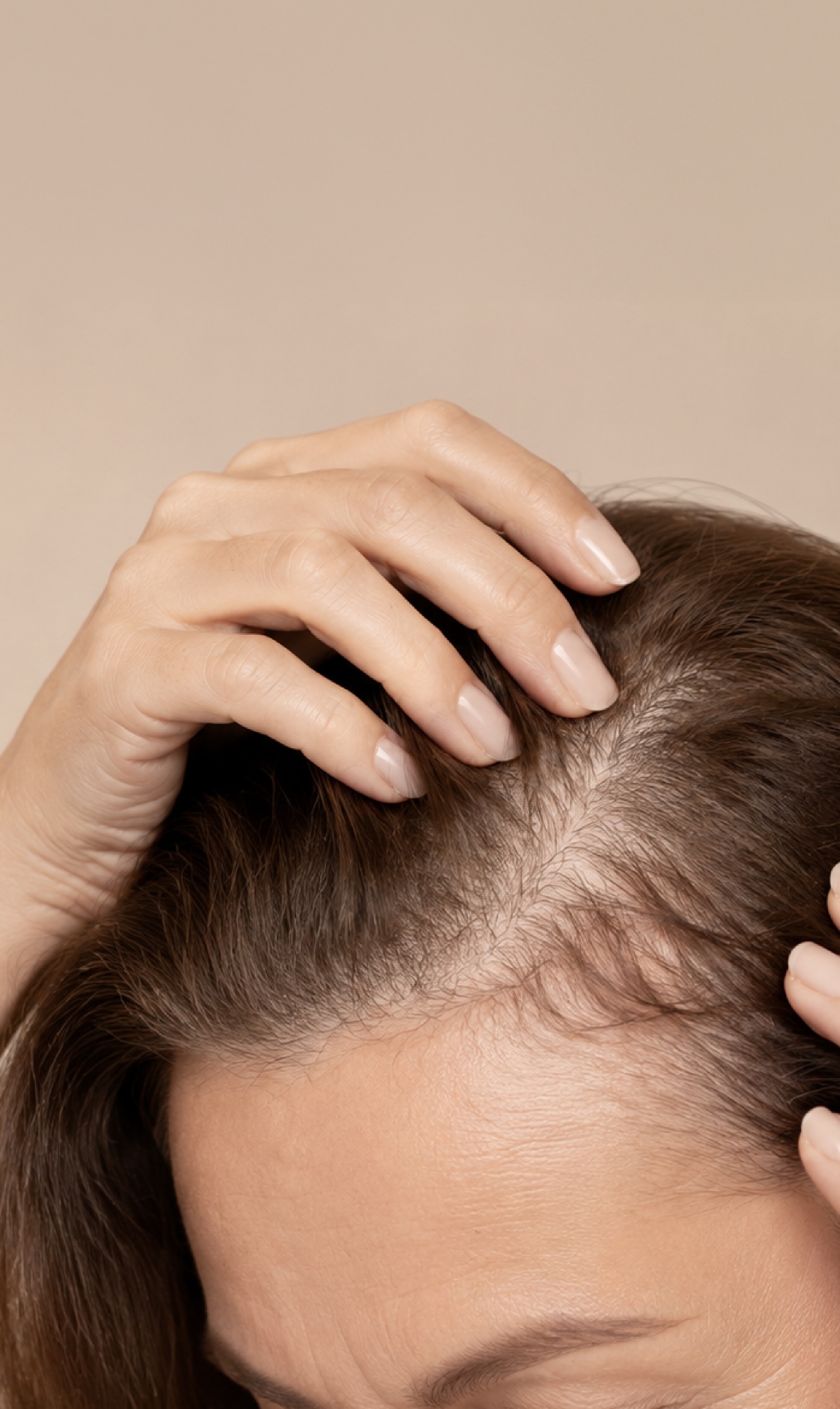 Close-up of a person parting their brown hair to reveal thinning hair and scalp, with hands on either side of the head.